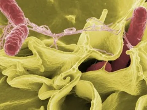 TPHCM: Tình trạng học sinh nghi ngộ độc thực phẩm tại Trường Bình Quới Tây hiện ra sao?