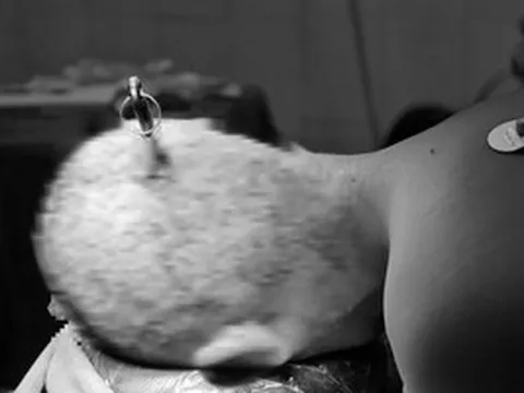 Hai học sinh nhập viện vì tai nạn học đường từ trò đùa nghịch