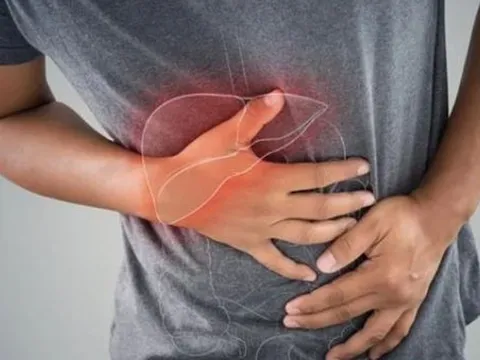 Nam thanh niên không uống rượu vẫn bị gan nhiễm mỡ nặng, bác sĩ chỉ rõ "thủ phạm" là thói quen "cực độc"