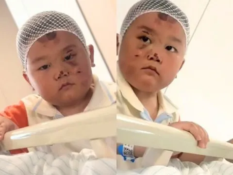Bé trai 3 tuổi mặt đầy vết thương túc trực chăm mẹ nằm giường bệnh, câu chuyện phía sau ai nghe cũng nghẹn lòng
