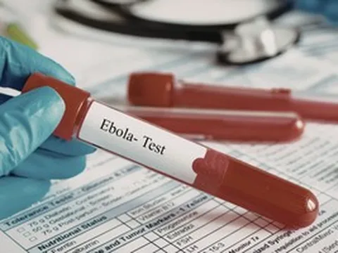 TPHCM tăng cường giám sát cửa khẩu, chủ động phòng nguy cơ dịch bệnh Ebola xâm nhập