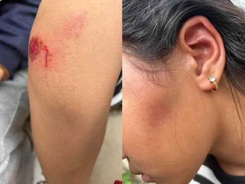 Nữ sinh lớp 6 bị đánh hội đồng, bắt quỳ dưới nắng, lau chân