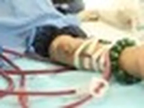 Bệnh viện Bạch Mai cảnh báo: Suy thận đang trẻ hóa, nhiều người tuổi 20 phải lọc máu