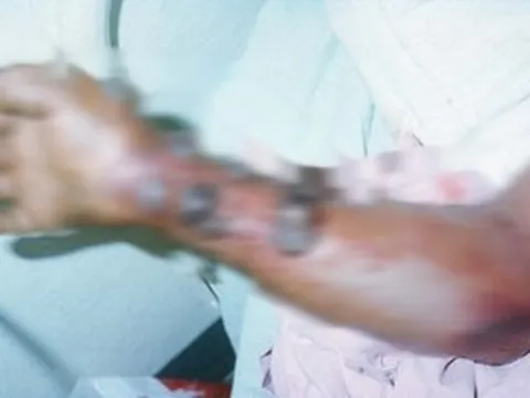 Vì sao WHO đánh giá nguy cơ Ebola vào Việt Nam ở mức thấp?