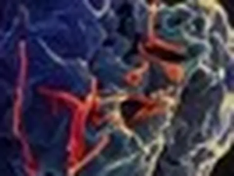 Bộ Y tế đánh giá về nguy cơ dịch Ebola đối với Việt Nam