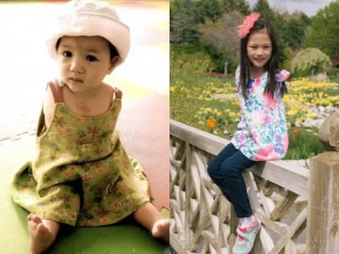 Bị bố mẹ bỏ rơi vì khuyết 2 tay, bé gái sơ sinh lớn lên đẹp chuẩn Hoa hậu, cuộc sống đổi khác khi được nhận nuôi