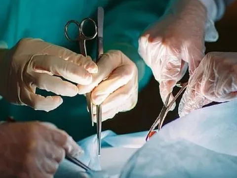 Nhập viện vì đau bụng, người đàn ông 67 tuổi sốc nặng khi bác sĩ gắp ra thứ "đáng sợ" đen sì