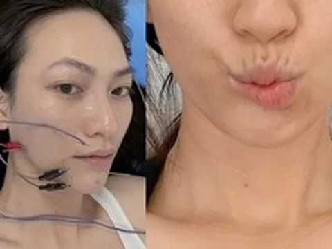 Nữ chính phim trăm tỷ của Trấn Thành: Từng đi bán xôi lề đường, bị biến chứng sau ca mổ tuyến giáp