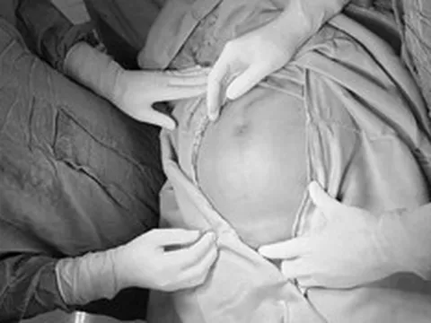 Bụng to nhanh bất thường, người phụ nữ "sốc" khi biết bí mật trong cơ thể