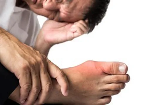 Chuyên gia Harvard: Người bệnh gout nên ăn gì?