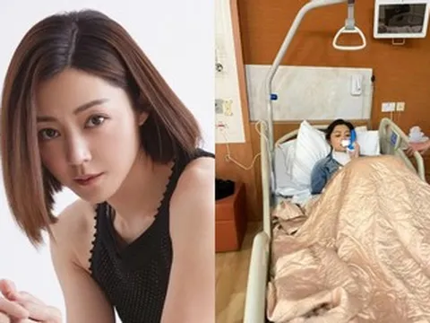 Nữ diễn viên 42 tuổi khâu hơn 50 mũi sau tai nạn trên phim trường