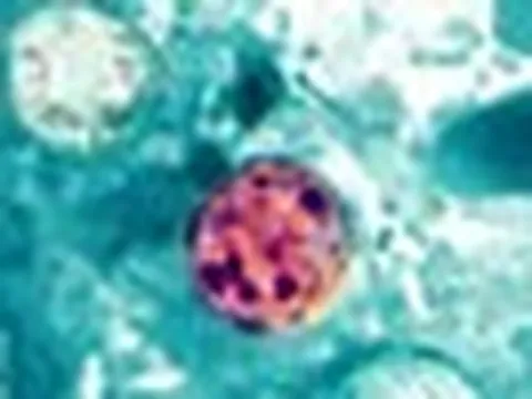 Mỹ ghi nhận ca tử vong đầu tiên liên quan đến đợt dịch Cyclospora