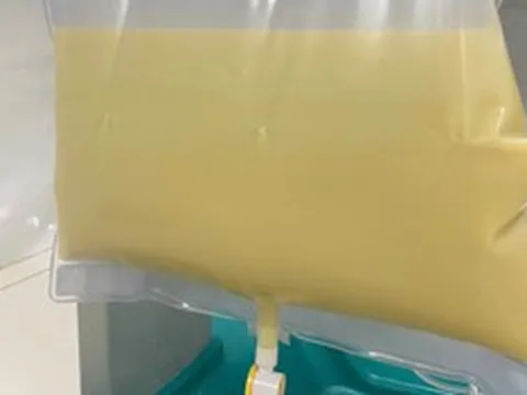 Nam thanh niên "máu trắng đục như sữa" vì ăn thứ quen thuộc nhiều người mê