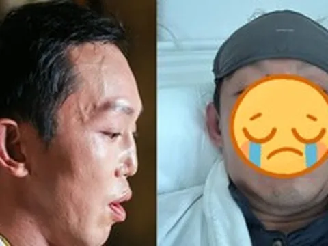 Nam thần màn ảnh vỡ nát mặt mũi sau vụ bị xe tông, tốn 13 tỷ sửa dung mạo bố mẹ vẫn nhận không ra