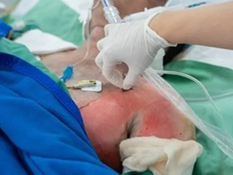 Tình trạng sức khỏe các nạn nhân vụ cháy nhà khiến 2 người tử vong