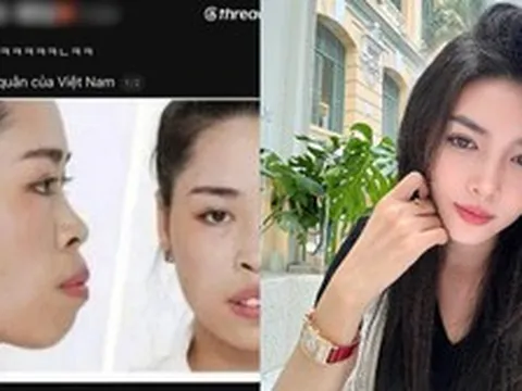 Người đẹp từng lột xác thành công nhờ "dao kéo" vướng lùm xùm liên quan đến miệt thị ngoại hình người Việt